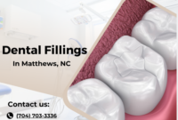 What Do Fillings Look Like? Dental Materials and Appearance Guide