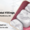 What Do Fillings Look Like? Dental Materials and Appearance Guide