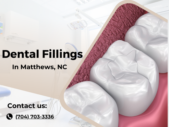 What Do Fillings Look Like? Dental Materials and Appearance Guide