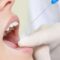 What Do Dentists Use for Numbing? Local Anesthesia Explained Simply