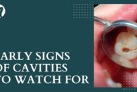 What Do Small Cavities Look Like? Early Dental Warning Signs