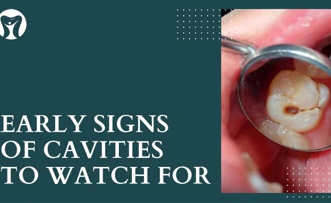 What Do Small Cavities Look Like? Early Dental Warning Signs