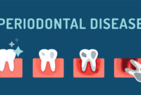 What Do Periodontists Do? Gum Specialists Explained Simply