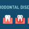 What Do Periodontists Do? Gum Specialists Explained Simply