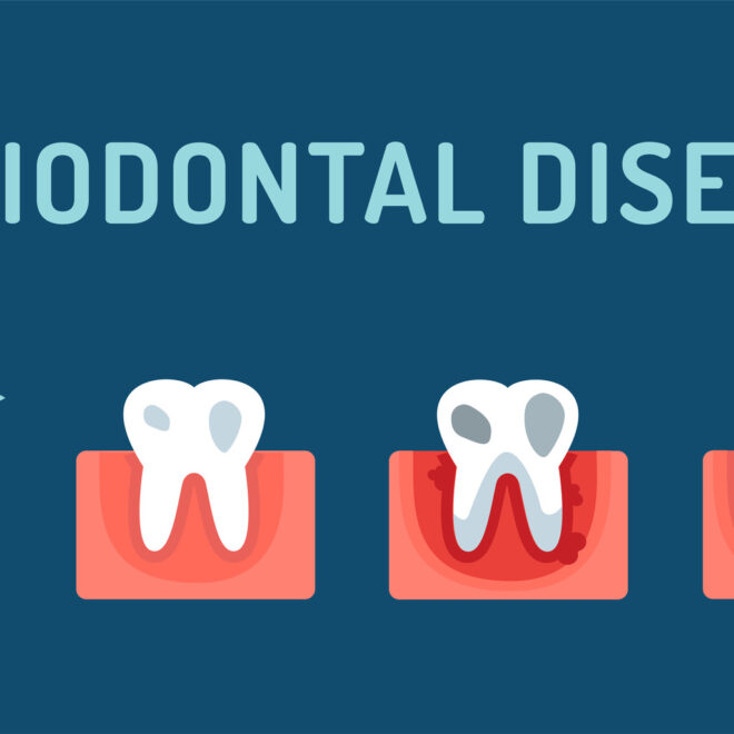 What Do Periodontists Do? Gum Specialists Explained Simply