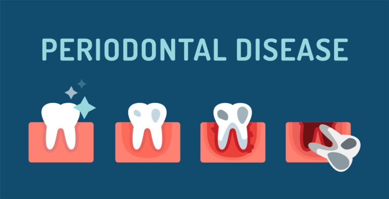 What Do Periodontists Do? Gum Specialists Explained Simply