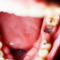 What Do Cavities Look Like on Teeth? Visual Warning Signs Explained