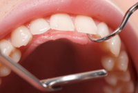 What Do Healthy Teeth Look Like? Signs of a Strong Smile