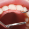 What Do Healthy Teeth Look Like? Signs of a Strong Smile