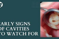 What Do Small Cavities Look Like? Early Dental Warning Signs
